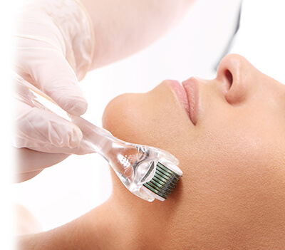 Initial Dermal Roller SR Treatment