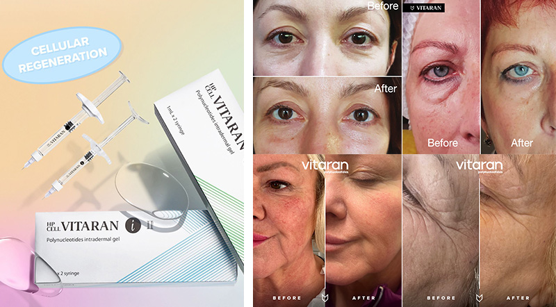 Dermaren Lumi Eyes Treatment